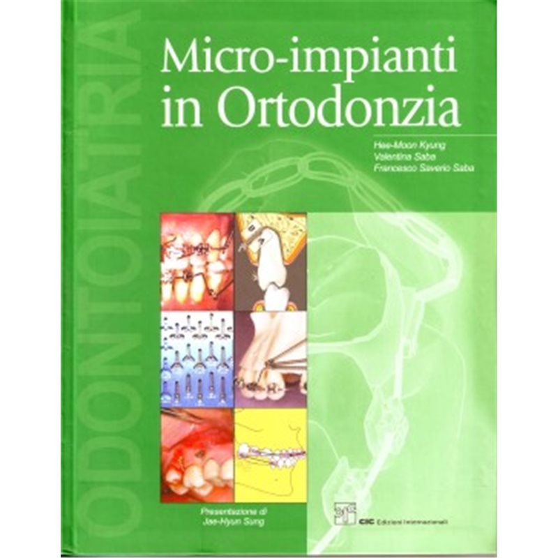 Micro-impianti in Ortodonzia
